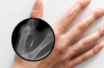 Mandatory Subcutaneous Microchips for Employees May Soon Be Banned in Washington State